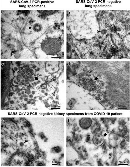 isce-se-virus-1-del-5